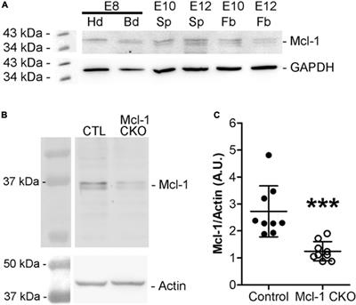 The Role of Mcl-1 in Embryonic Neural Precursor Cell Apoptosis